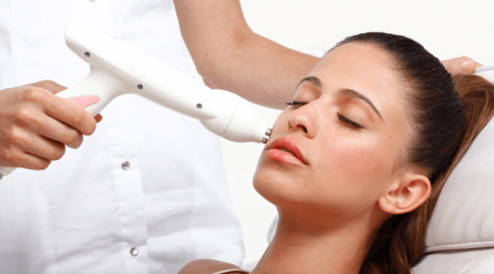 Un rejuvenecimiento con láser facial